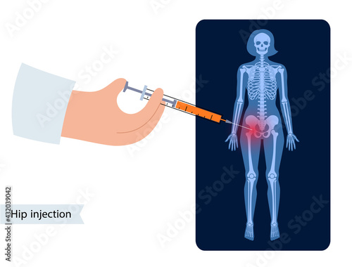 Hip joint injection
