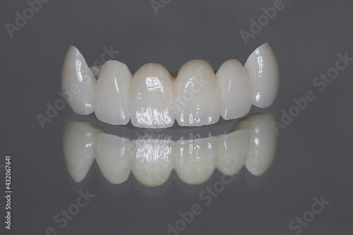 Zirconia bridge with all porcelain baked. reflection teeth on the mirror