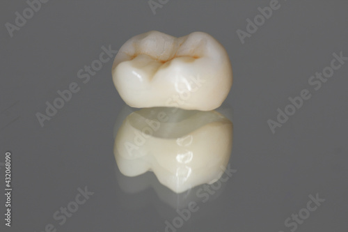 Zirconia crown with all porcelain baked. 