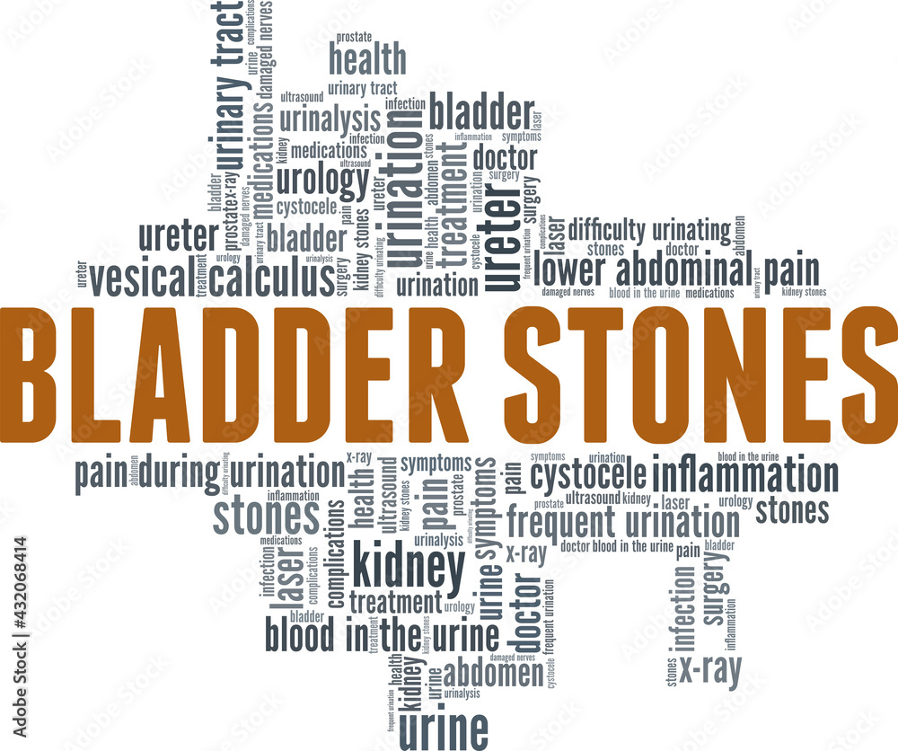 Bladder stones vector illustration word cloud isolated on a white background. Bladder stones vector illustration word cloud isolated on a white background.