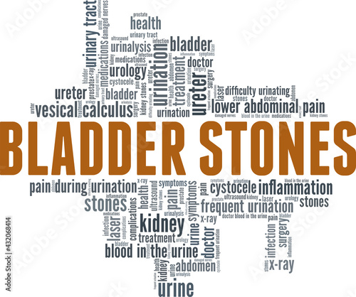 Bladder stones vector illustration word cloud isolated on a white background.