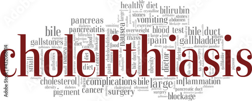 Cholelithiasis vector illustration word cloud isolated on a white background.