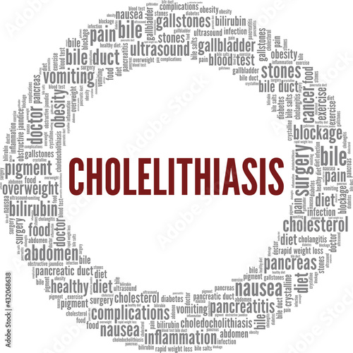 Cholelithiasis vector illustration word cloud isolated on a white background.