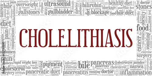 Cholelithiasis vector illustration word cloud isolated on a white background.