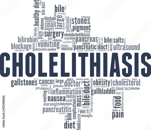 Cholelithiasis vector illustration word cloud isolated on a white background. photo