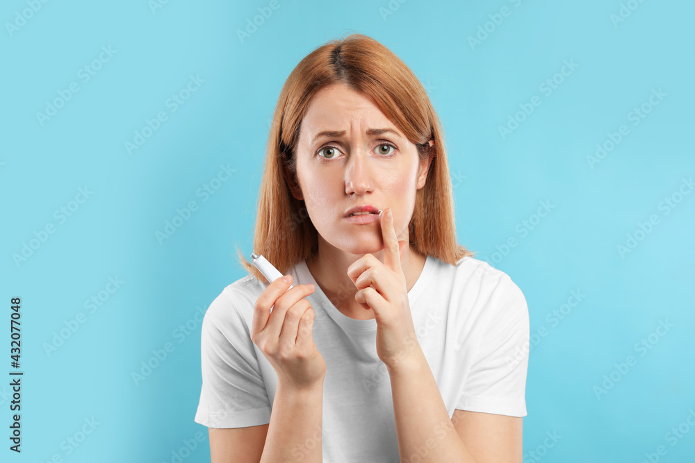 Upset woman with herpes applying cream on lips against light blue background Upset woman with herpes applying cream on lips against light blue background