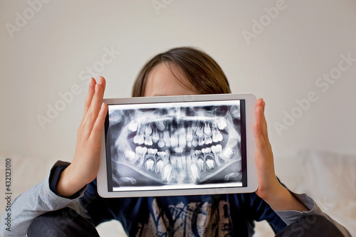Canvas Print Child, preteen boy, holding tablet with a picture of his x-ray teeth