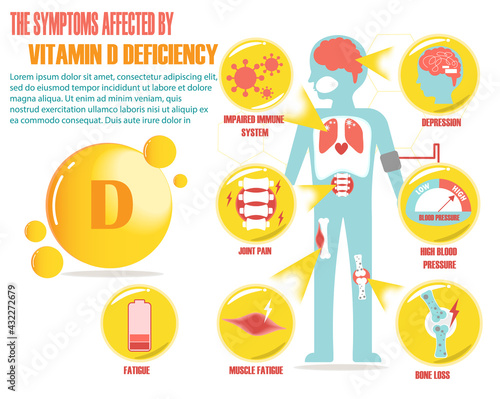 Infographic of vitamin D deficiency vector design, impaired immune system, mood swing, joint pain, blood pressure control, bone loss, body fatigue