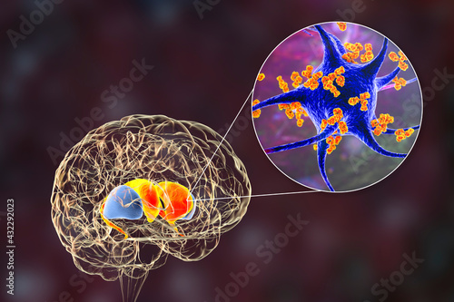 Anti-basal ganglia antibodies. 3D conceptual illustration photo