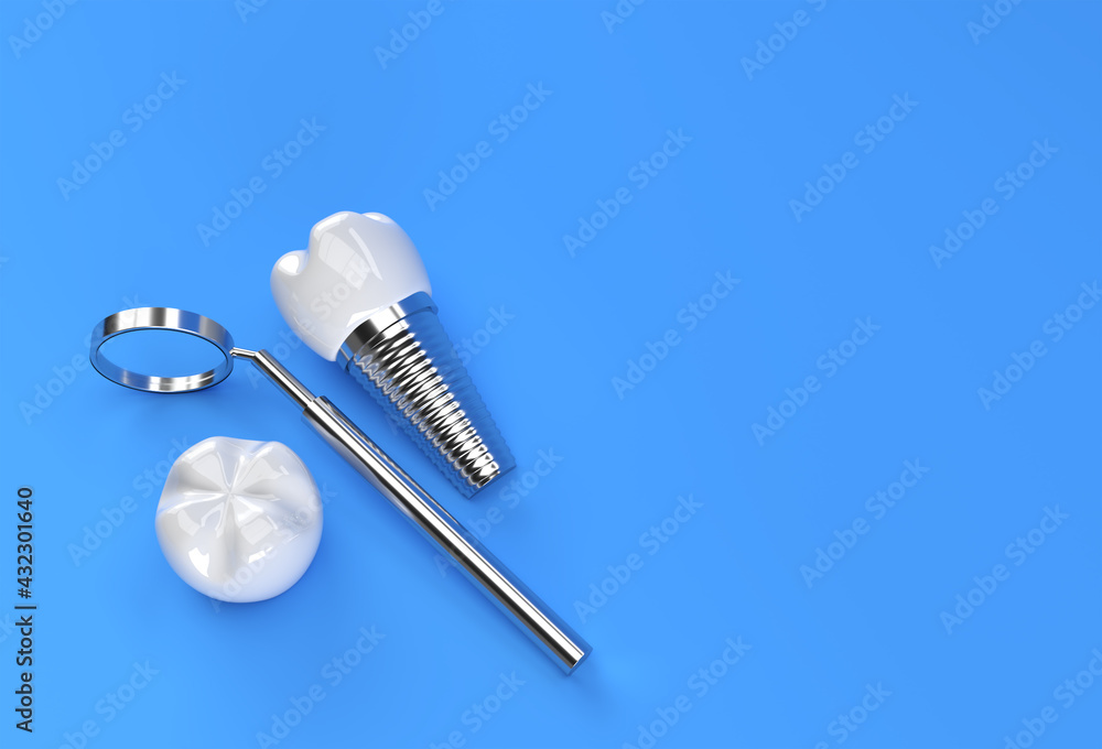 Dental Implants surgery concept 3D Rendering. Dental Implants surgery concept 3D Rendering.