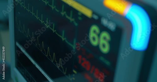 Close-up a patient monitor screen with some diagrams which are indicating the patient’s vital signs such as his heartbeat, blood pressure, level of oxygen.