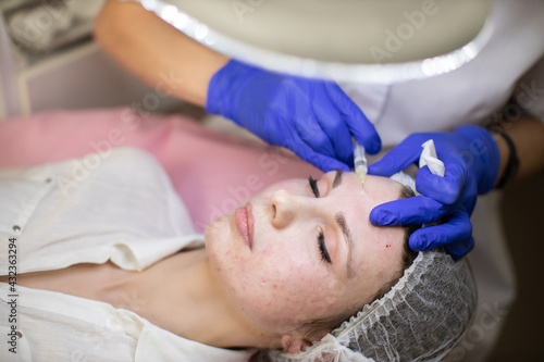 Mesotherapy, botulinum therapy, biorevitalization or plasma lifting of face skin. Close-up of hands of beautician making beauty injections of to young pretty woman in cosmetology clinic