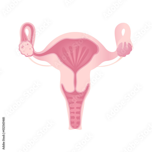Anatomy of the female reproductive system. The layout of the female reproductive organs: uterus, cervix, ovary, fallopian tube.