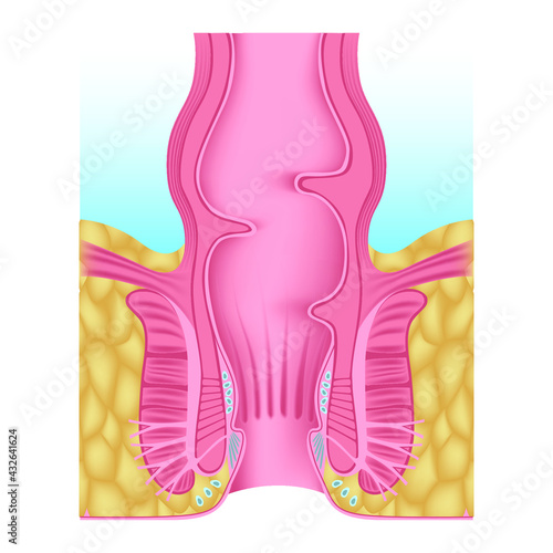 Anatomy of the human anal opening. Rectum. Medical poster. Vector illustration