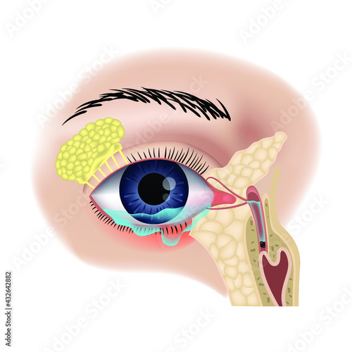 Teary inflamed eye. Blockage of the lacrimal sac or ducts. Anatomy of the organs of vision. Vector illustration
