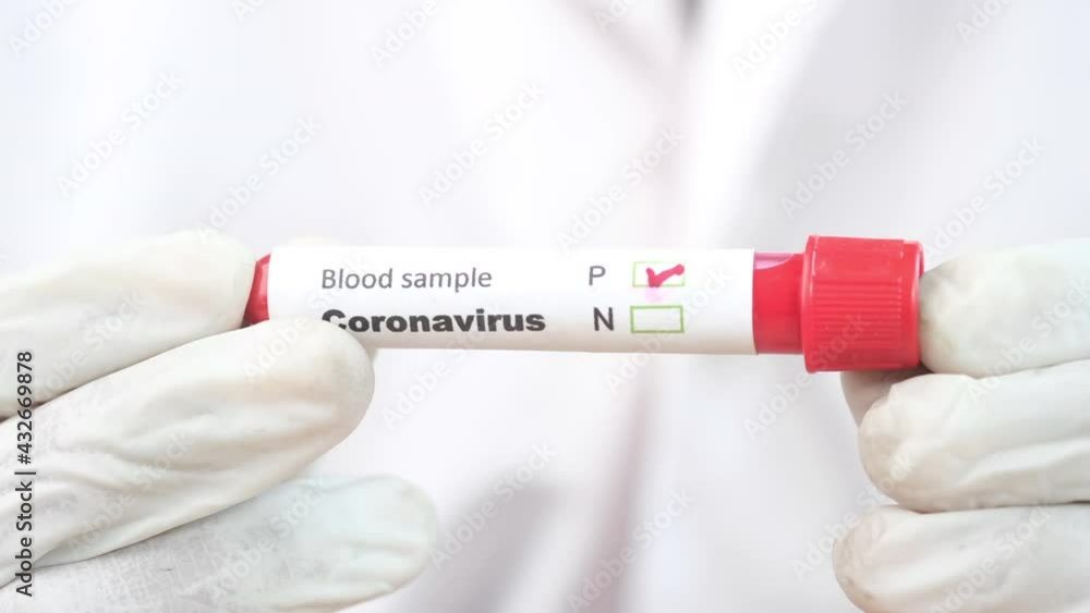 hand in medical gloves holding blood test tube hand in medical gloves holding blood test tube