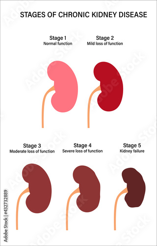 Kidney disease concept