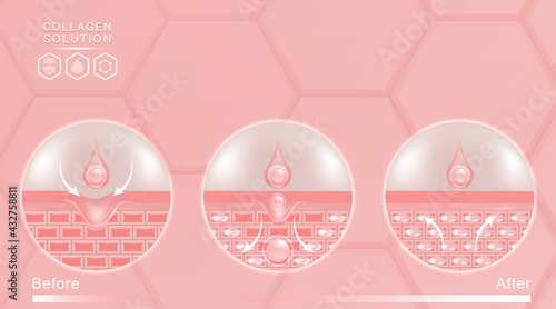 Hyaluronic acid before and after skin solutions ad, pink collagen serum drops with cosmetic advertising background ready to use, illustration vector.