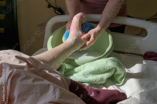 Washing the feet of a bedridden patient. A caregiver washes the leg of a patient with the syndrome. A basin with a washcloth. Concept of caring for a bedridden patient with dementia, stroke.