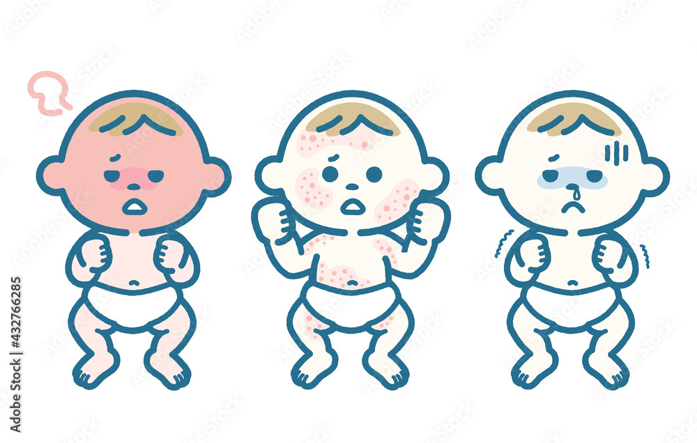 Various symptoms of infants