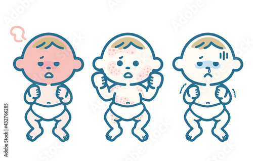 Various symptoms of infants