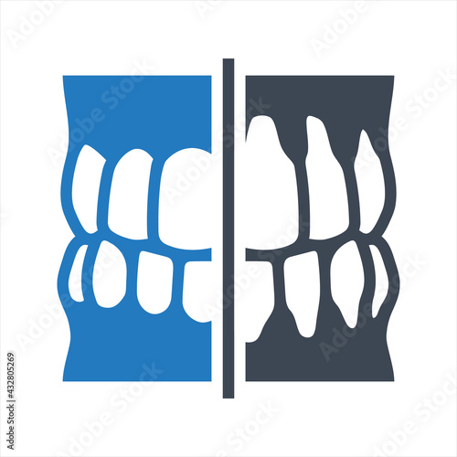 Teeth grafts icon, vector and glyph