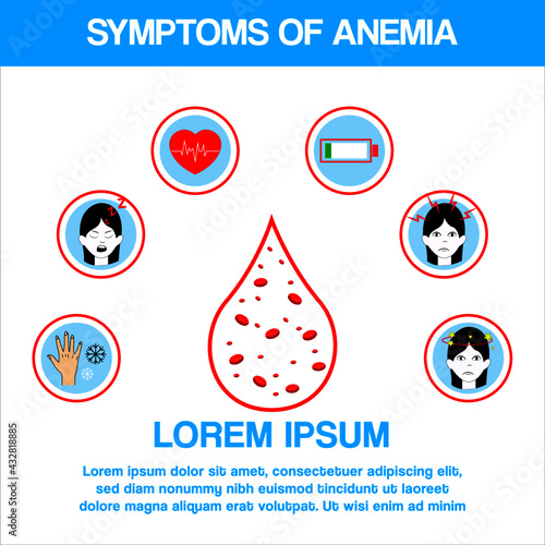 Infographic image of anemia. The difference between the number of red blood cells and the normal number of anemia. Realistic vector image of red blood cells or hemoglobin amount in human blood.Medical