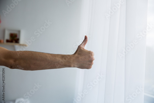 vitiligo hand shows great class