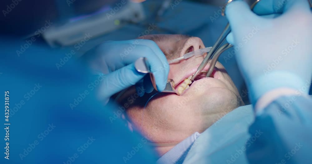 Close-up an adult male patient is laying and has anesthesia while the dentist is holding dental retractor and forceps with surgical thread and assistant holding inside of his mouth saliva ejector. Close-up an adult male patient is laying and has anesthesia while the dentist is holding dental retractor and forceps with surgical thread and assistant holding inside of his mouth saliva ejector.