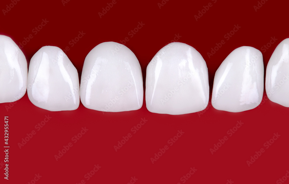 Ceramic dentures and crowns on black background. Top view on set of