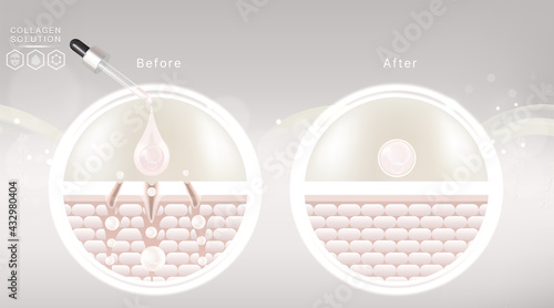 Hyaluronic acid before and after skin solutions ad, white collagen serum drops with cosmetic advertising background ready to use, illustration vector.