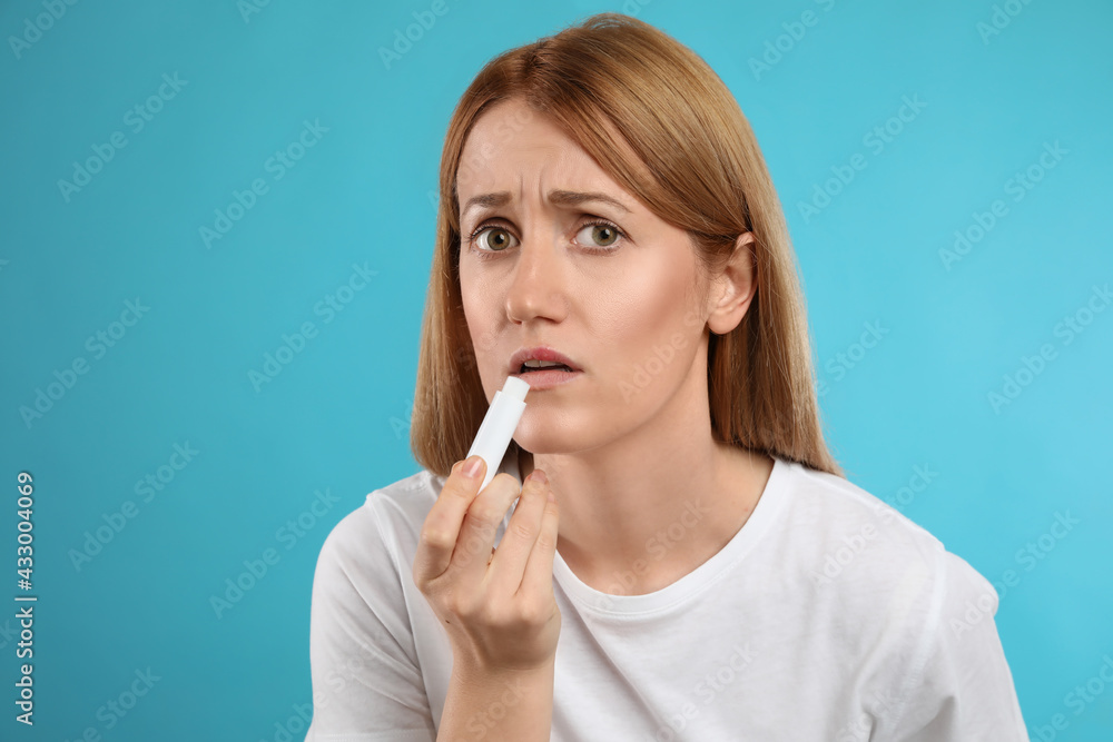 Upset woman with herpes applying lip balm against light blue background Upset woman with herpes applying lip balm against light blue background