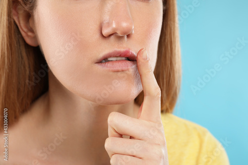 Foto Woman suffering from herpes on light blue background, closeup