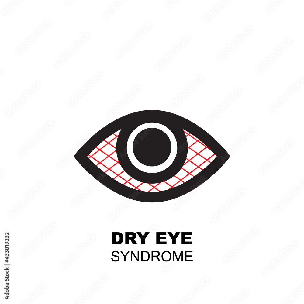 Dry Eye Syndrome Icon, Tired Sleepy Eye Symbol Isolated Stock Vector