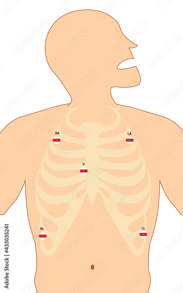 ECG (Electrocardiography) 5 electrode system ECG (Electrocardiography) 5 electrode system