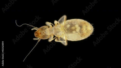 book lice Liposcelis sp. under the microscope, of the Liposcelidae family. photo