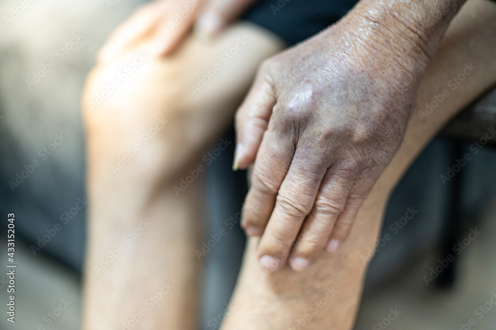 The hand of old man with the wrinkled hand and bruised from the body lack of nutrition protein. The hand of old man with the wrinkled hand and bruised from the body lack of nutrition protein.