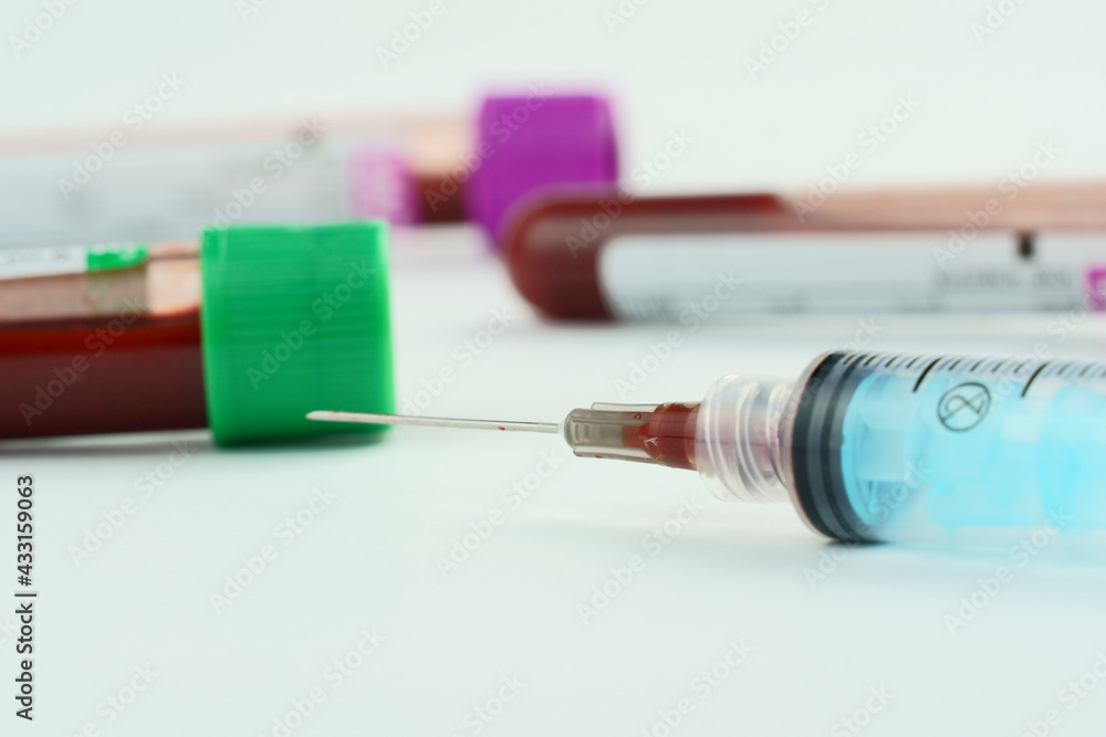Vacuum tubes for collection and blood samples on white background..Transparent with purple and green cap and a syringe. Label to identify the data. Selective focus. Vacuum tubes for collection and blood samples on white background..Transparent with purple and green cap and a syringe. Label to identify the data. Selective focus.