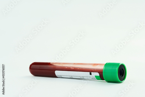 Vacuum tube for collection and blood samples on white background..Transparent with green cap. Label to identify the data. Selective focus.