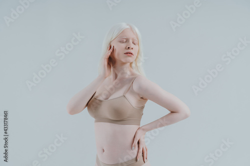 Beauty image of an albino girl posing in studio wearing lingerie. Concept about body positivity, diversity, and fashion photo
