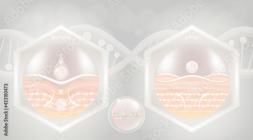 Hyaluronic acid before and after skin solutions ad, white collagen serum drops with cosmetic advertising background ready to use, illustration vector.