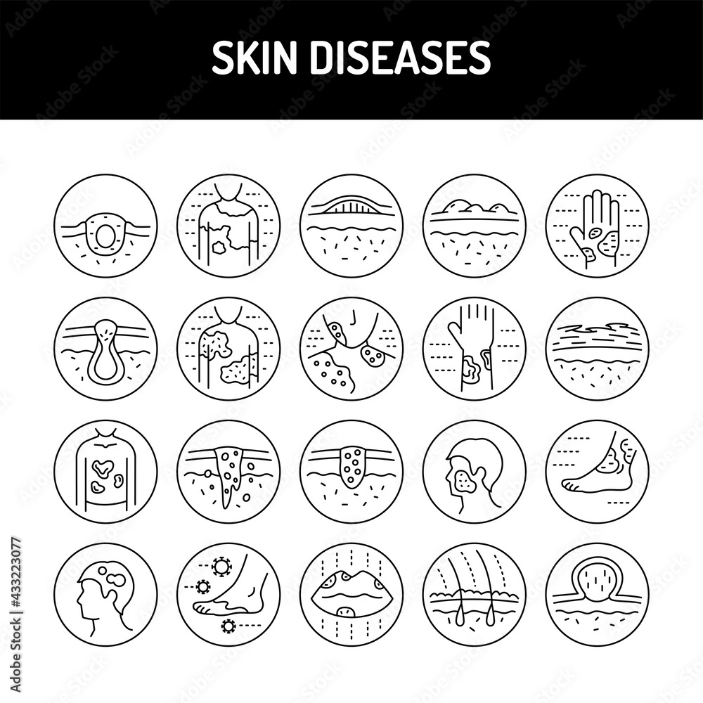 Skin diseases line icons set. Isolated vector element.