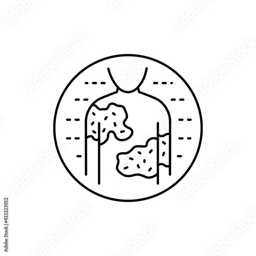 Urticaria color line icon. Dermatology disease. Isolated vector element.