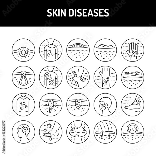 Skin diseases line icons set. Isolated vector element.