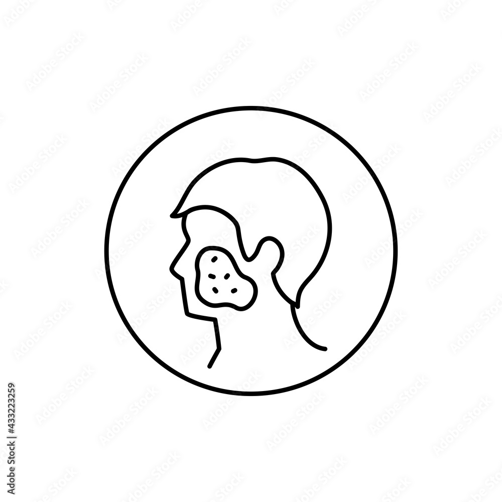 Rosacea black line icon. Dermatology disease. Isolated vector element. Rosacea black line icon. Dermatology disease. Isolated vector element.