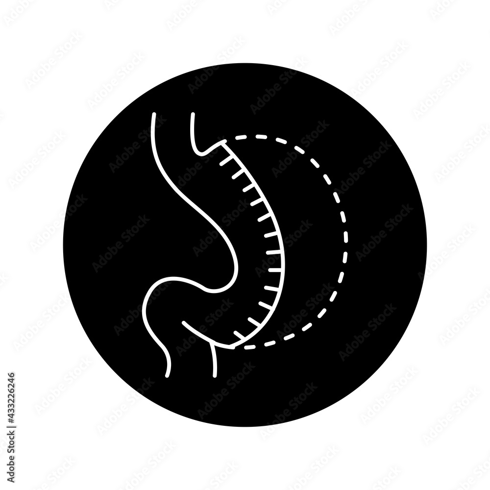 Obraz premium Sleeve gastrectomy olor line icon. Pictogram for web page, mobile app, promo.