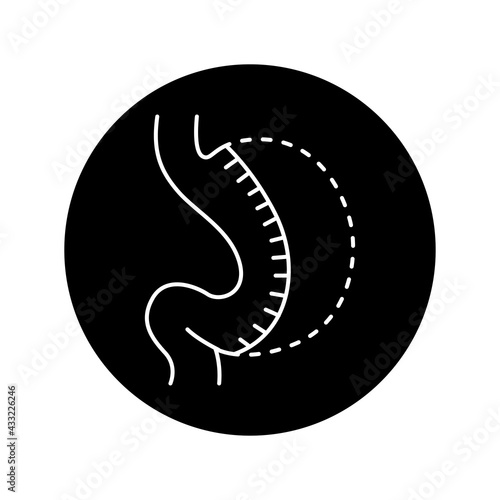 Sleeve gastrectomy olor line icon. Pictogram for web page, mobile app, promo.