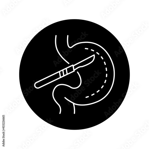 Stomach surgery olor line icon. Pictogram for web page, mobile app, promo.