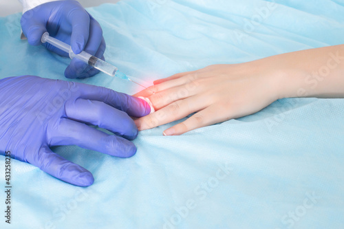 The doctor makes an injection in the joint of the finger on the hand for arthritis, pain and inflammation in the joint. Concept for pain relief injections with glucosteroids