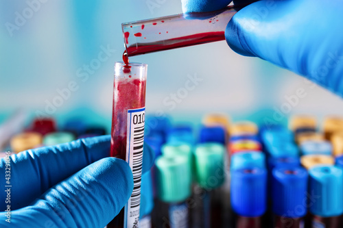 technician working in laboratory with blood samples to stain smear and slide. The lab technician who mixes the blood sample in different tubes can contaminate the samples photo